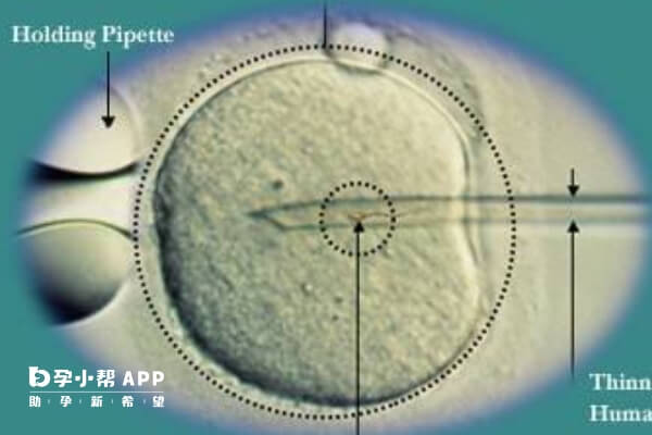 胚胎722是中等质量的胚胎