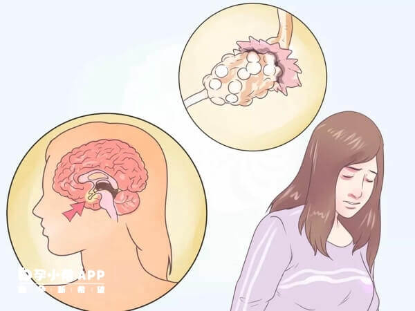 性激素六项可以判断女性内分泌水平