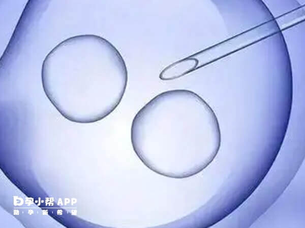 单身女性可以去泰国试管婴儿