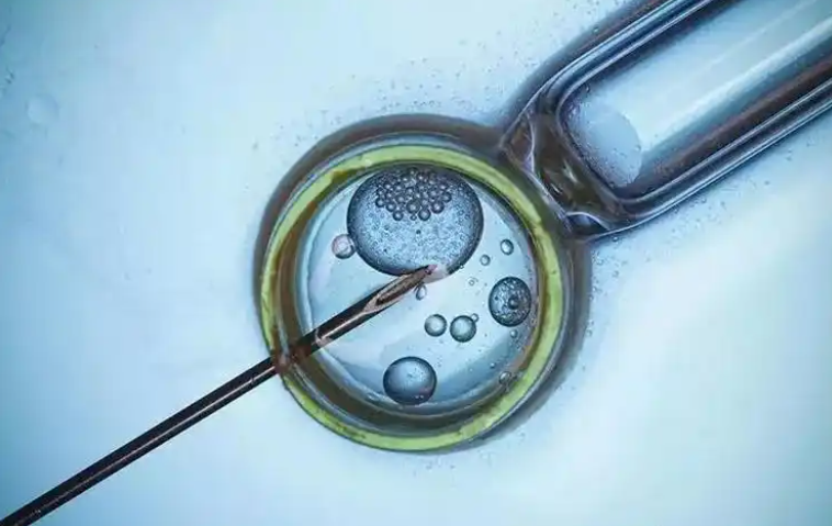 济南齐鲁不孕不育生殖医院哪家成功率高？内