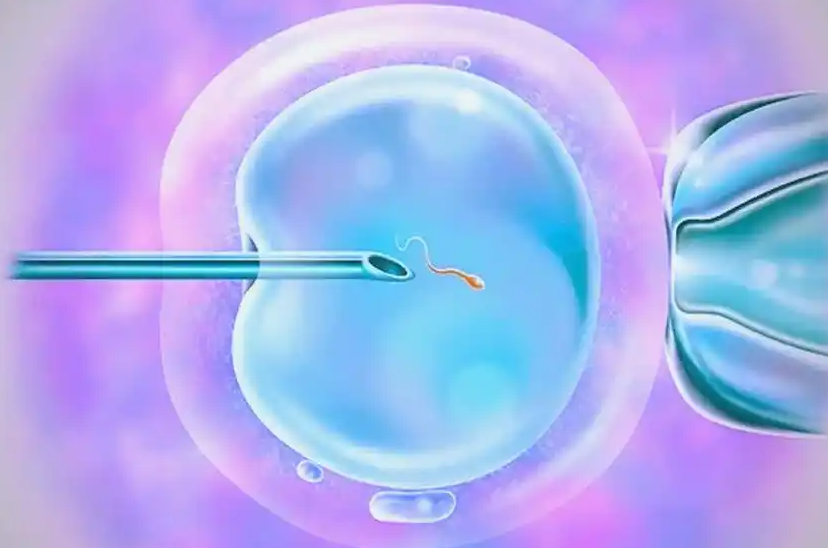 单身男性去泰国做三代试管助孕要多少钱？